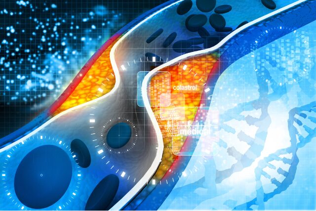 動脈硬化の血管イメージ